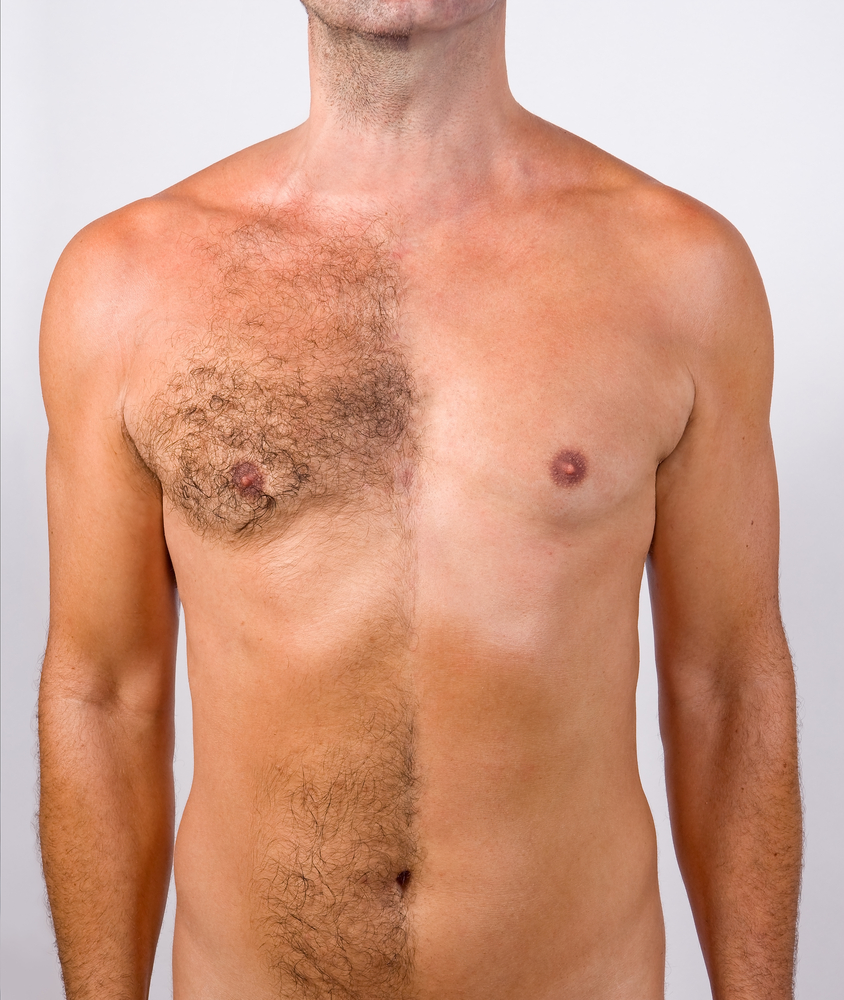 стрижка волос на груди у мужчин фото 2