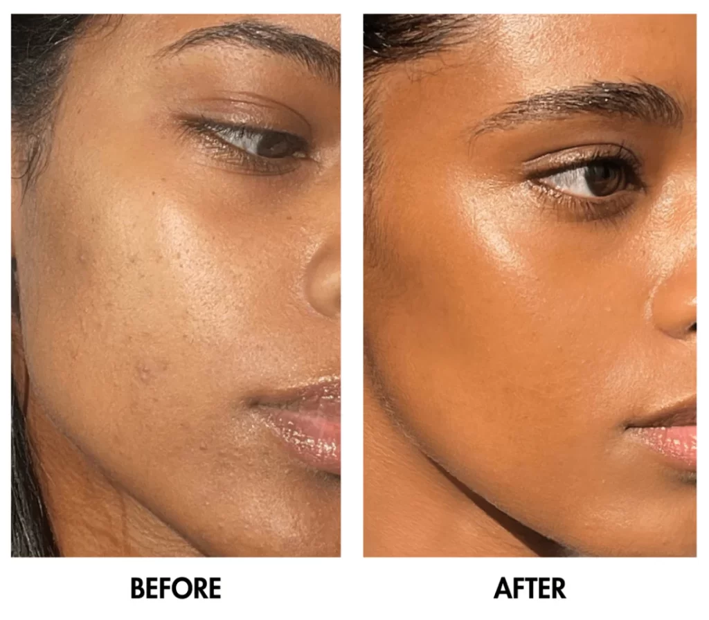 Lelite Medispa